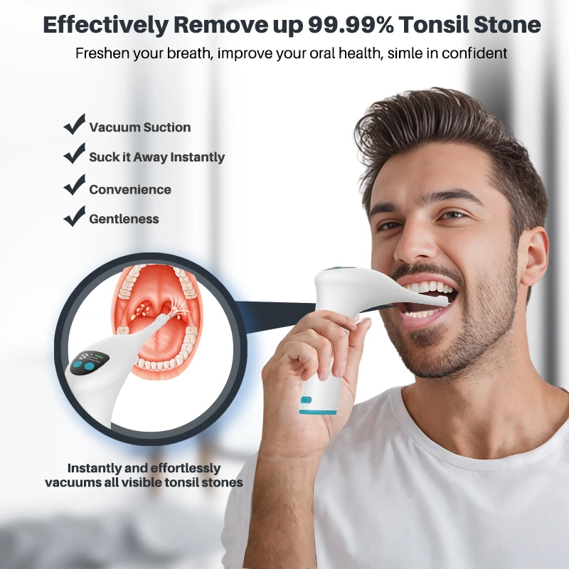 Smart Tonsil Stone Removal Device Smart Tonsil Stone Removal Device