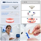 The Guide To Launching Your Ultrasonic Cleaner Dental
