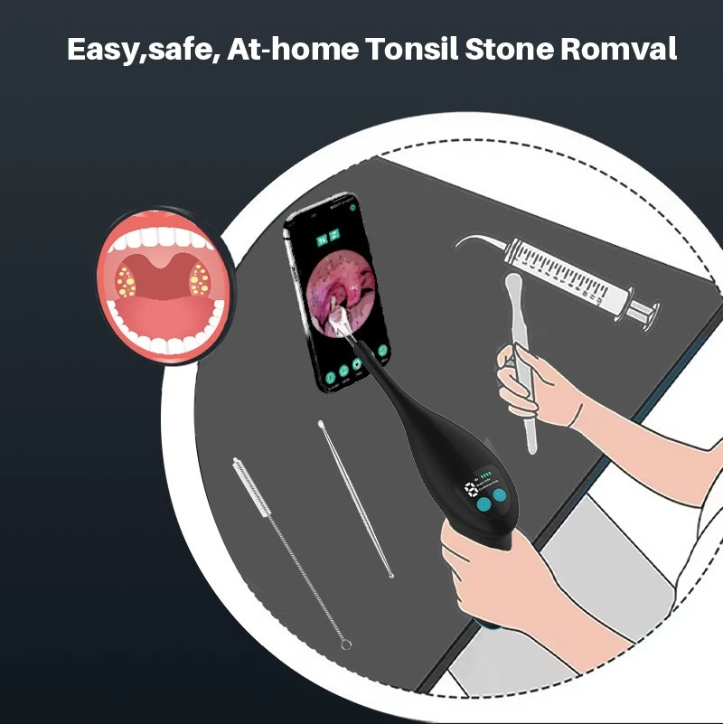 Tool To Remove Tonsil Stones price