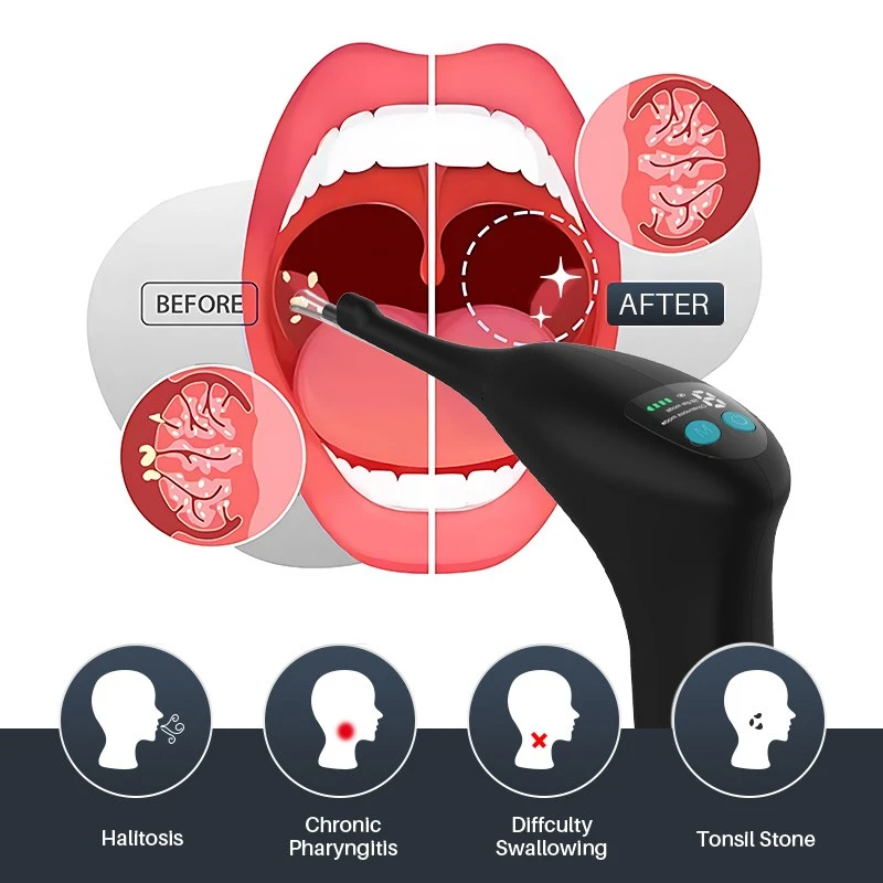 Tool To Remove Tonsil Stones suppliers