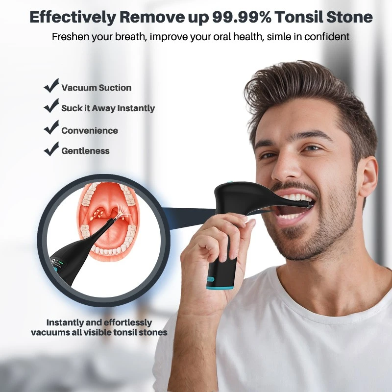 Tool To Remove Tonsil Stones factory